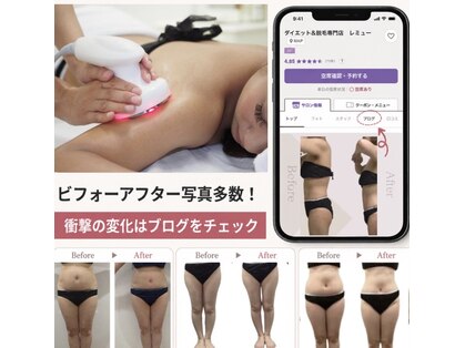 レミューの写真