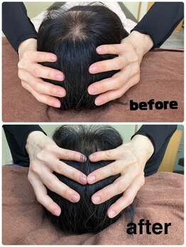 Rストレッチ/【変化】ビフォーアフター