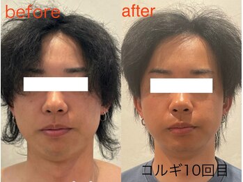 ビーキュート 姫路店(BE-CUTE)/小顔コルギ10回目