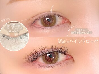 マミノン 武蔵小杉(Maminon)/LEDで【矯正×バインドロック】