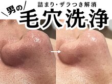 ユアースタイル 四日市店(YOUR Style)の雰囲気（毛穴の汚れ・詰まりにお悩みの方へ...ザラつく肌をすっきり解消!）