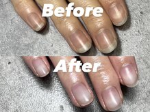 結(Yui)/自爪育成 Before→After