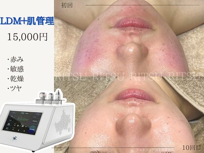 リツ(Ritsu)の写真