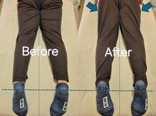 スノー シャイン(SNOW SHINE)/【Before→After】