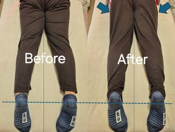 スノー シャイン(SNOW SHINE)/【Before→After】