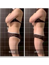 インナーメス(INNER MES)/痩身全身で薄い体へ