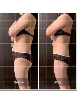 インナーメス(INNER MES)/痩身全身で薄い体へ