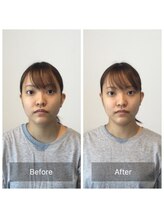 美容整体プラスフィール 横浜店/美容整体/エステ/リラク