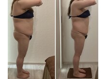 チェリオール(Cherioll)/WINBACKボディ　2ヶ月半後