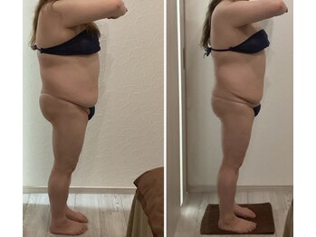 チェリオール(Cherioll)/WINBACKボディ　2ヶ月半後