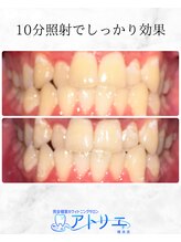 アトリエ 横浜店/ホワイトニングサロン/横浜