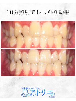 アトリエ 横浜店/ホワイトニングサロン/横浜