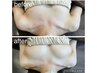 【バストのハリ・垂れ改善特化】バストケア美姿勢矯正コース