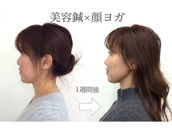 ユイユイマール(Yui Yui Maru)/たった1週間でこの変化☆