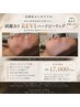 目指すは韓国人のような艶美肌♪『REVI陶肌ハードピーリング』