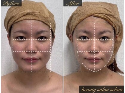 「小顔に本気。」都度払い小顔専門店beauty salon seloveの写真