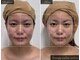 「小顔に本気。」都度払い小顔専門店beauty salon seloveの写真