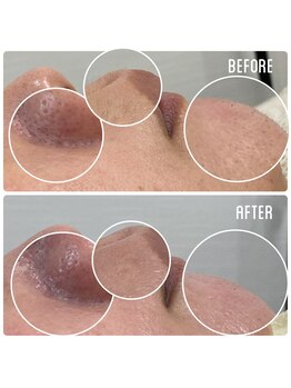 ファウラ(faura:)/マリムーブワックス認定