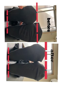 Rストレッチ/【変化】ビフォーアフター