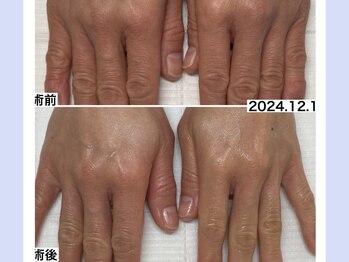 ベッレ マーニ/ハンドケア