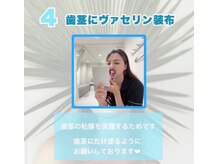 ホワイトニングショップ 銀座7丁目店(WHITENING SHOP)/【照射の流れ】４
