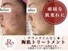 【頑固な肌荒れに】REVIハーブピーリング+生酵素パウダー1g