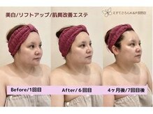 えすてさろん ケイアンドエフ(k&f)の雰囲気(肌質改善×美白×小顔ケア。透明感とハリが蘇る極上フェイシャル)