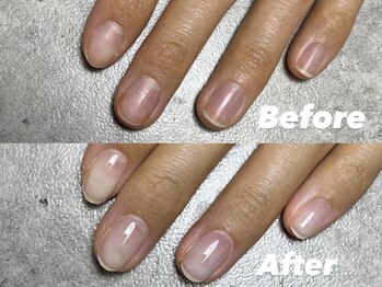 結(Yui)/自爪育成 Before→After