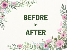 グラツィア(Grazia)/エステbefore/after