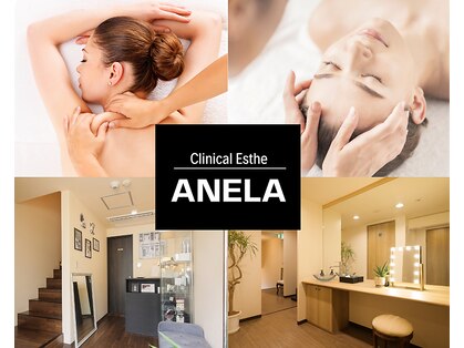 アネラ(ANELA)の写真