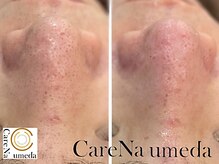 ケアナ 梅田店(CareNa)/メンズの清潔感ここにあり