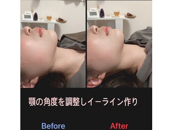 美容矯正サロン レレポノ(LELEPONO)/