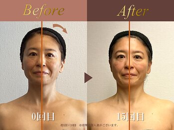 オーシャン(Ocean)/全身美容矯正120分/週1回×15回