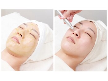 エム 銀座(M)の写真/【毛穴レス美肌No.1】厳選ハーブピーリング！¥22000→¥8800神エステ★貴女も極上スッピン美肌