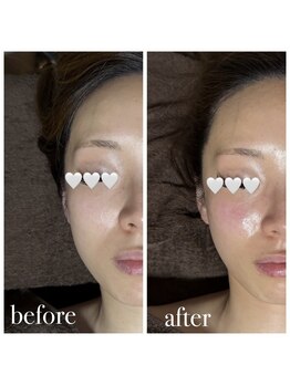 エルミオ エスパシオ ミロク(El mio espacio 369miroku)/CARBOXY～お顔編～