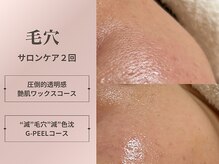 ウララカ(uraraca)の雰囲気("目指すお肌")