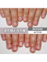 スマイルニコ(smile nico)/今日からは深爪ではなくなります