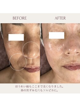 クラームビューティー(Clerm beauty)/リアボーテハーブトリートメント