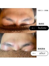 エスト(Est_.)/美容電気脱毛【脱毛経験無・眉】