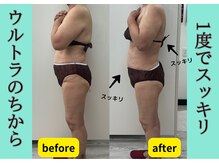 ヒールパーム(Heal Palm)の雰囲気（眠れる痩身で筋膜ケア！持続力あり続けることでスッキリボディ☆）