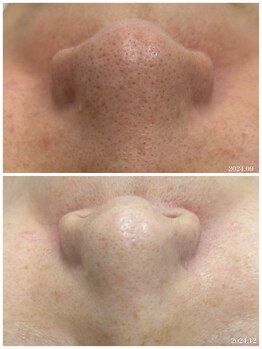 ヒルナム(Heal Nam)/プロセルセラピーズ~フェイス~