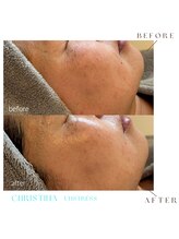 シェア(share.)/クリスティーナ　アンストレス