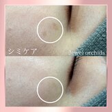 ジュエルオーキッド(Jewel orchids)