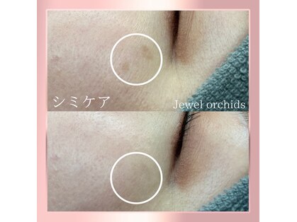 ジュエルオーキッド(Jewel orchids)の写真