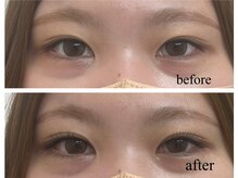 ブレス セルバテラス泉店(BLESS)/フラットラッシュ100本