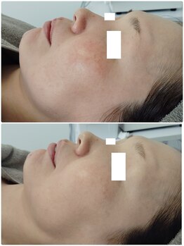 ビーユー(Be.you)/お肌の色ムラキレイに