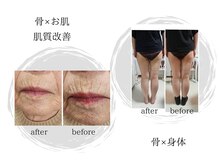 シュエット(chouette)の雰囲気（骨盤矯正で「頭痛や肩こり、不眠が改善した」とのお声多数◎）