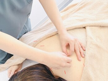 TJMととの鍼灸院の写真/思春期から更年期、ご高齢の方まで、女性鍼灸師が女性特有のお悩みに対応します♪