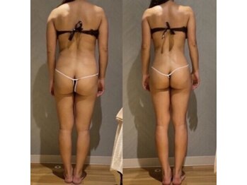 サリーエミリー(Sally Emiry)の写真/夏までに変わりたいあなたへ。無理なく続く本気の痩身ケア◎