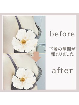 アリサナ(Arisana)/「下着の隙間が埋まった!」